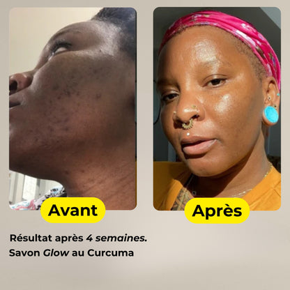 Savon Glow au Curcuma & Kojic